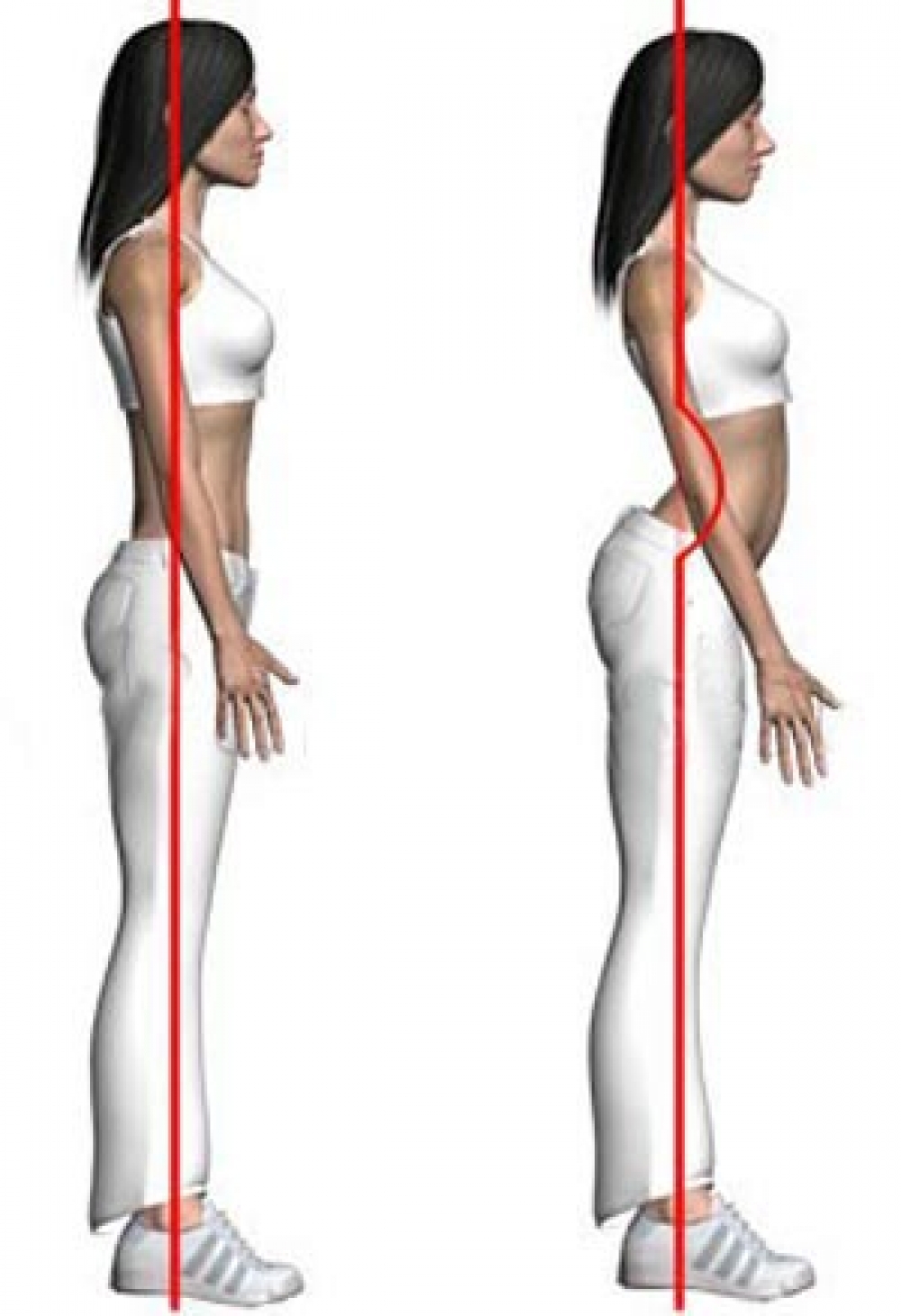 ورزش و حرکات اصلاحی گودی و قوس کمر